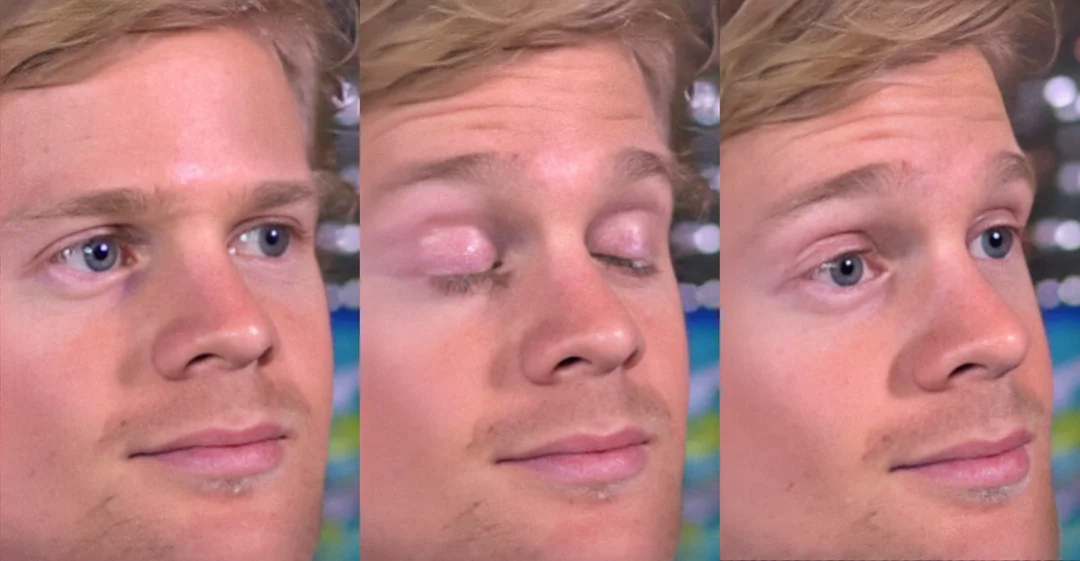 Blinking White Guy